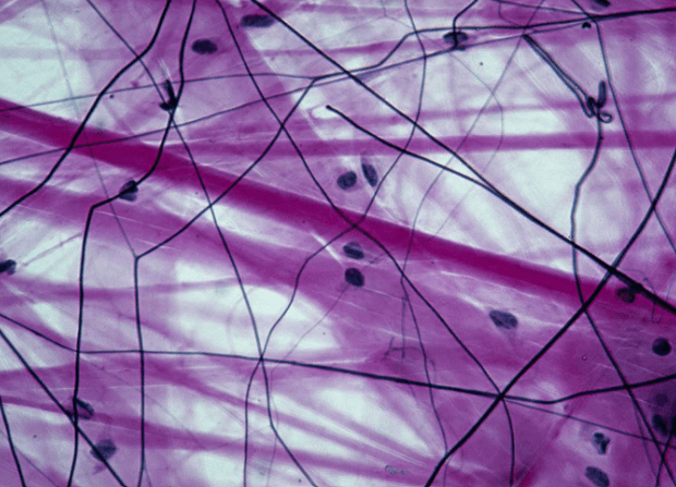 Difference Between Plant Tissue and Animal Tissue_12.1